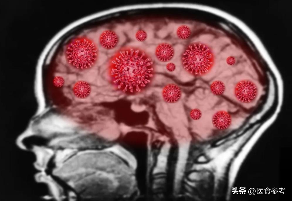 全球面临最新病毒感染的严峻挑战